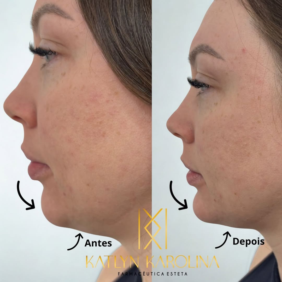 Resultado de contorno facial