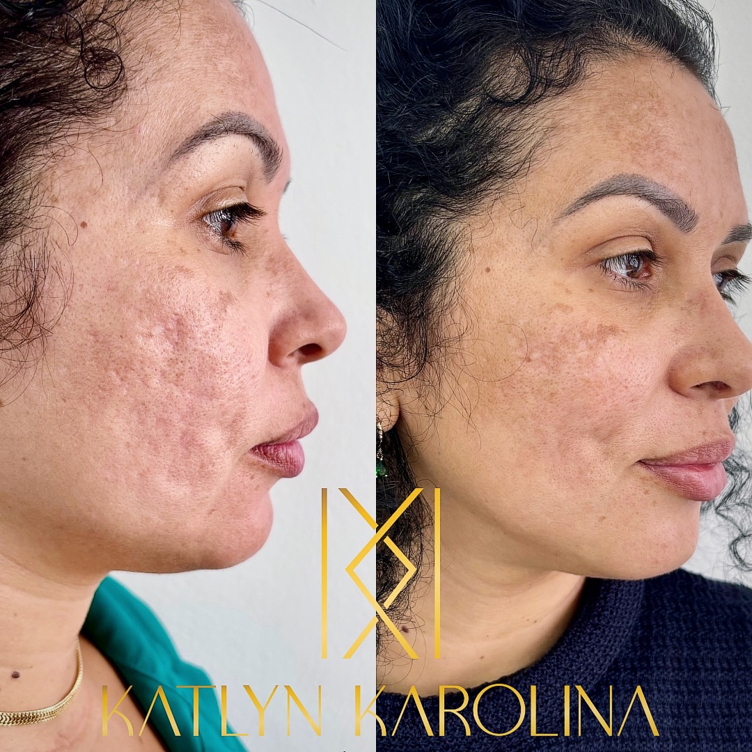 Resultado de definição de mandíbula